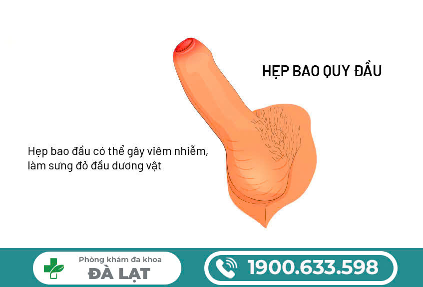 Hình ảnh minh họa